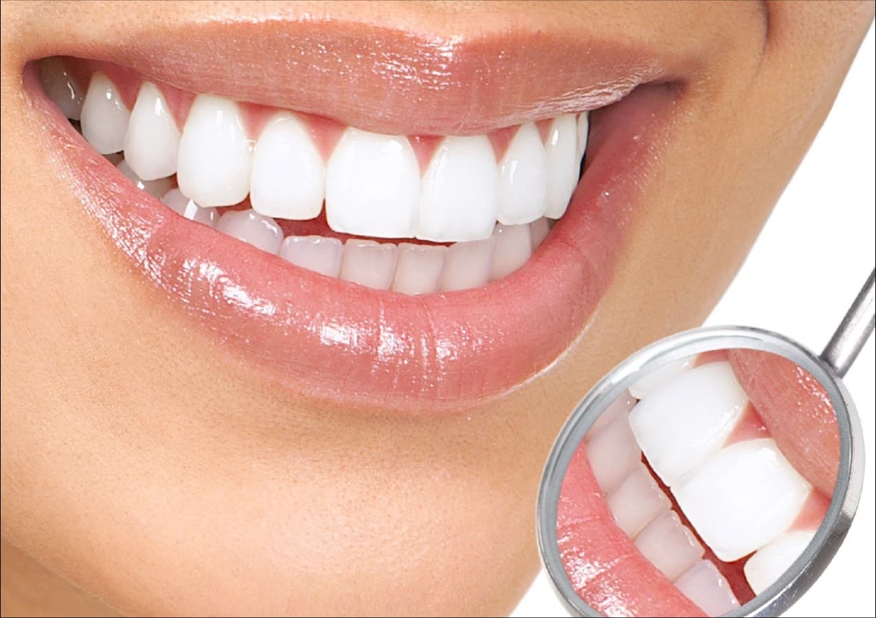 Branqueamento dentário em Odivelas: é seguro e vale a pena?